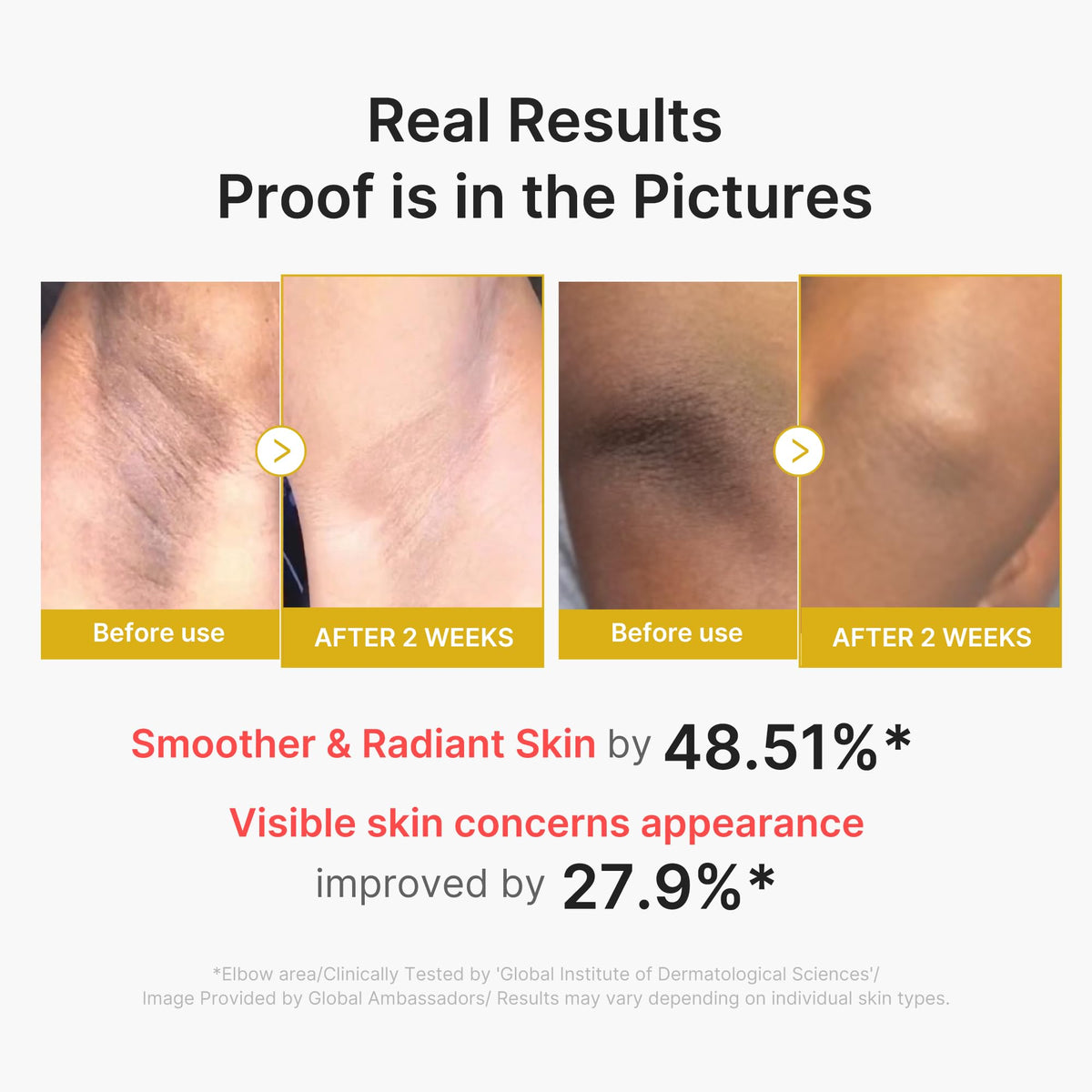 medicube applying serum on elbow to reduce rough, bumpy skin