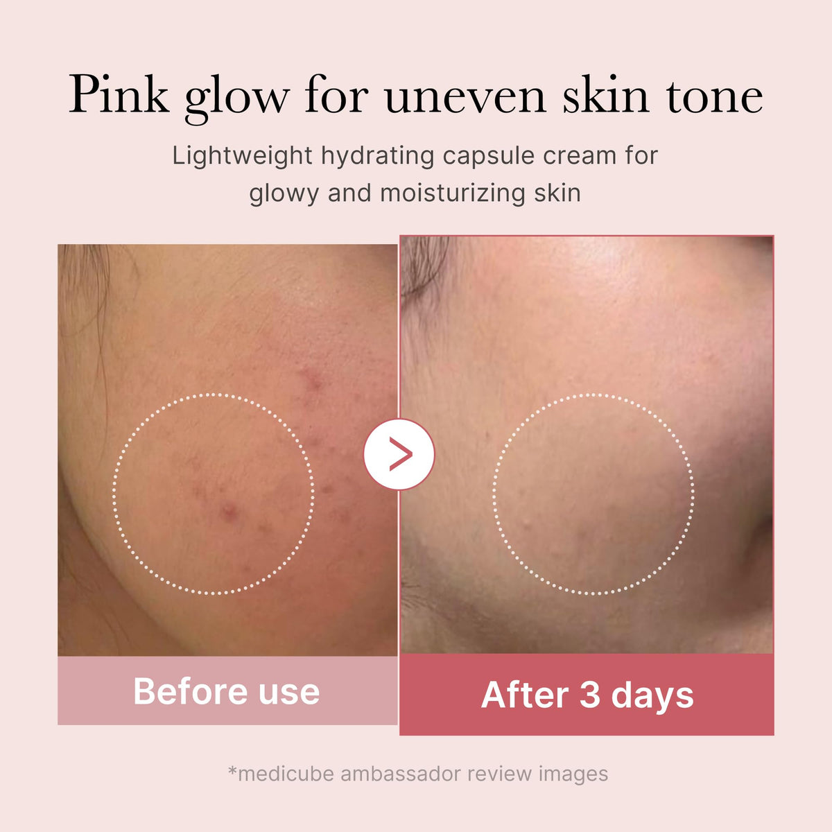 medicube cream in hand being blended indicating easy application and comfort