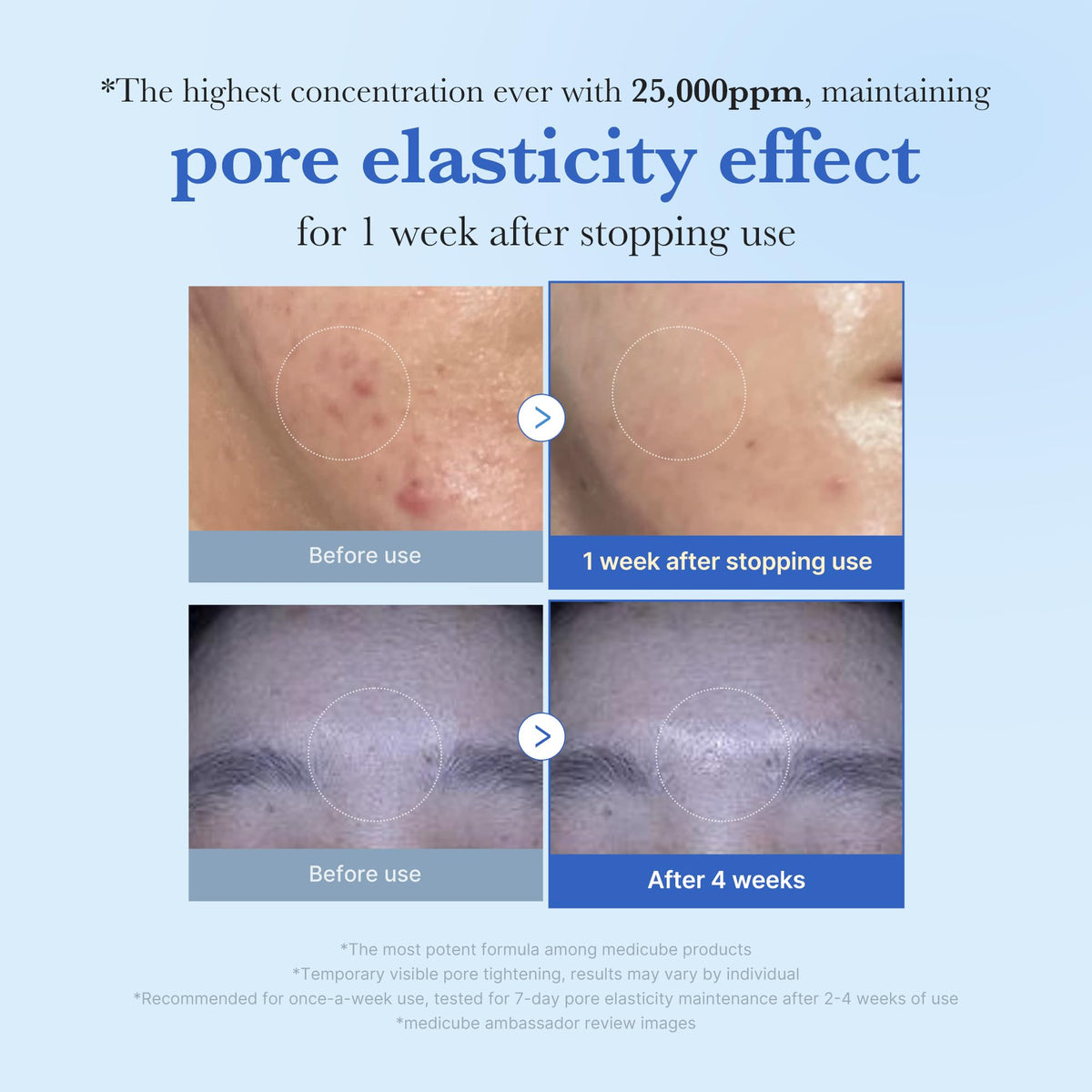 medicube close-up of spicule particles highlighting targeted delivery benefit