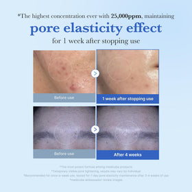 medicube close-up of spicule particles highlighting targeted delivery benefit