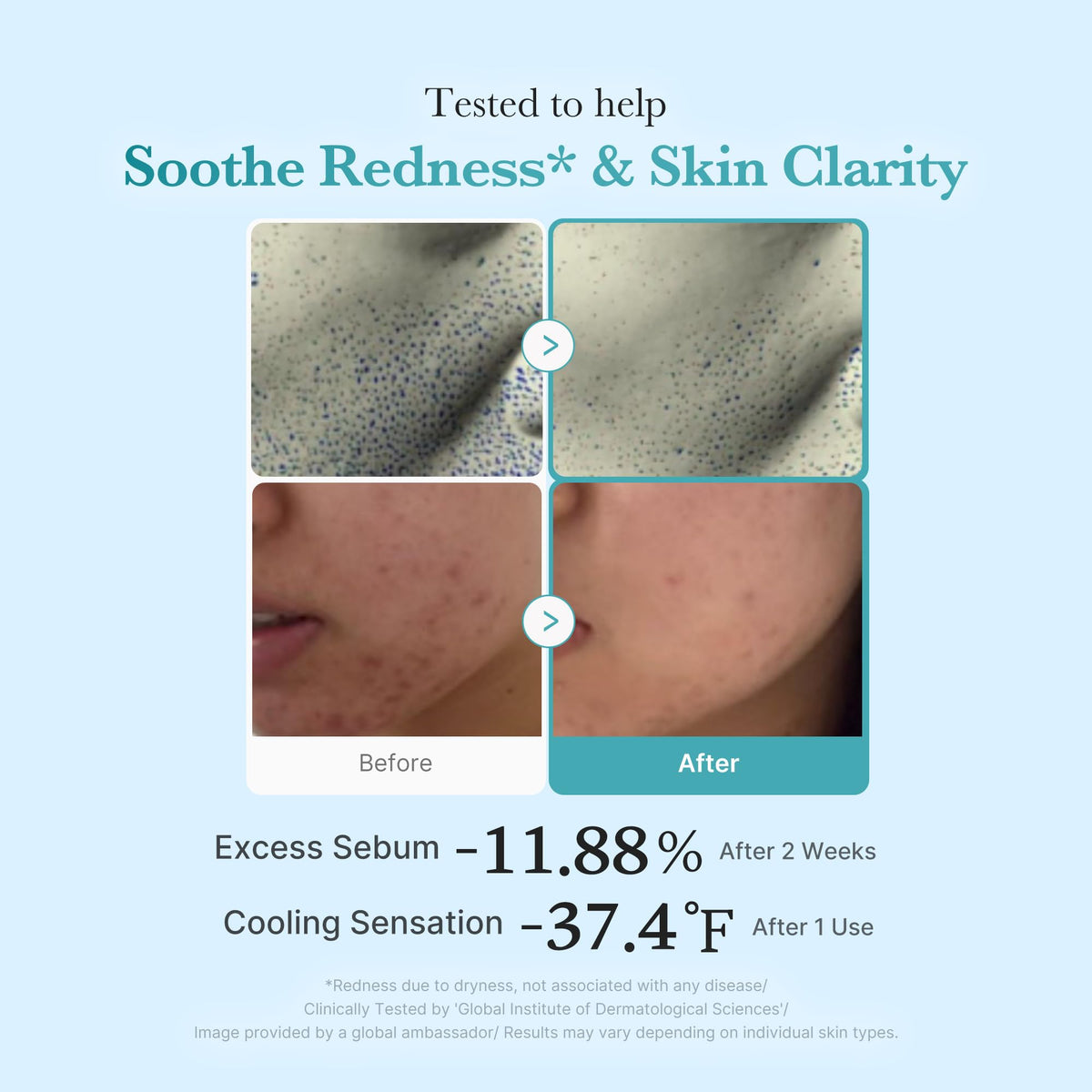 medicube label emphasizing 4% azelaic acid and 2% niacinamide benefits