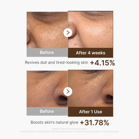 medicube label close-up listing niacinamide and hyaluronic acid benefits