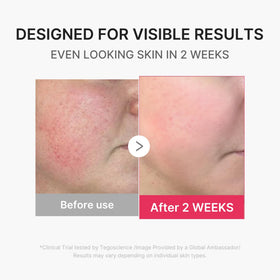 medicube device emitting purple light in lifestyle scene to boost radiance and glow benefit