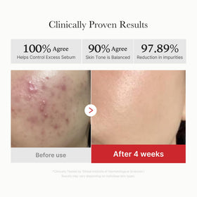 medicube pad in hand applying to skin demonstrating convenient use