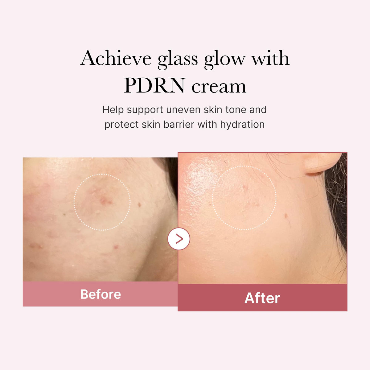 medicube rose pdrn ingredient visual highlighting recovery support and soothing