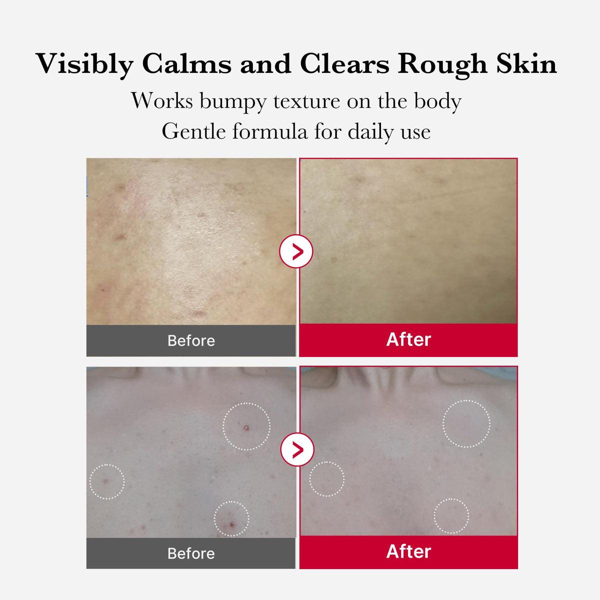 medicube red liquid texture on palm, visible micro-encapsulation benefit
