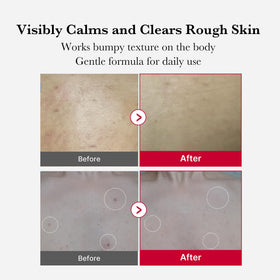 medicube red liquid texture on palm, visible micro-encapsulation benefit