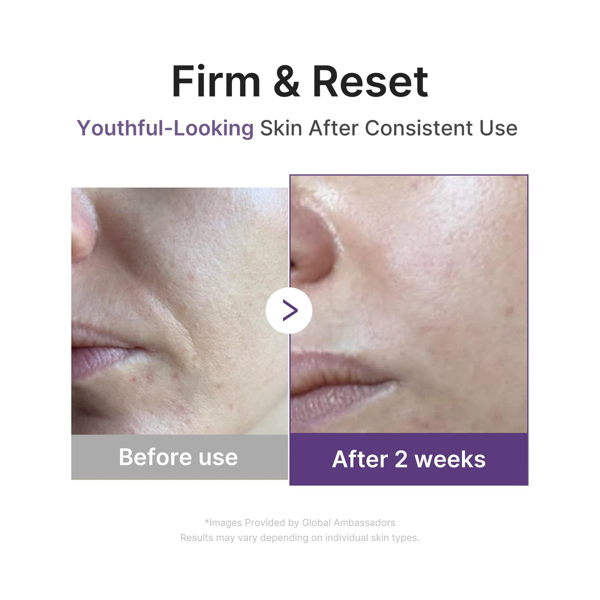 medicube retinol droplets on surface highlighting targeted resurfacing support