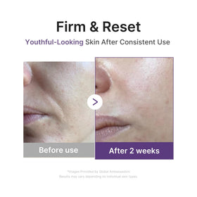 medicube retinol droplets on surface highlighting targeted resurfacing support