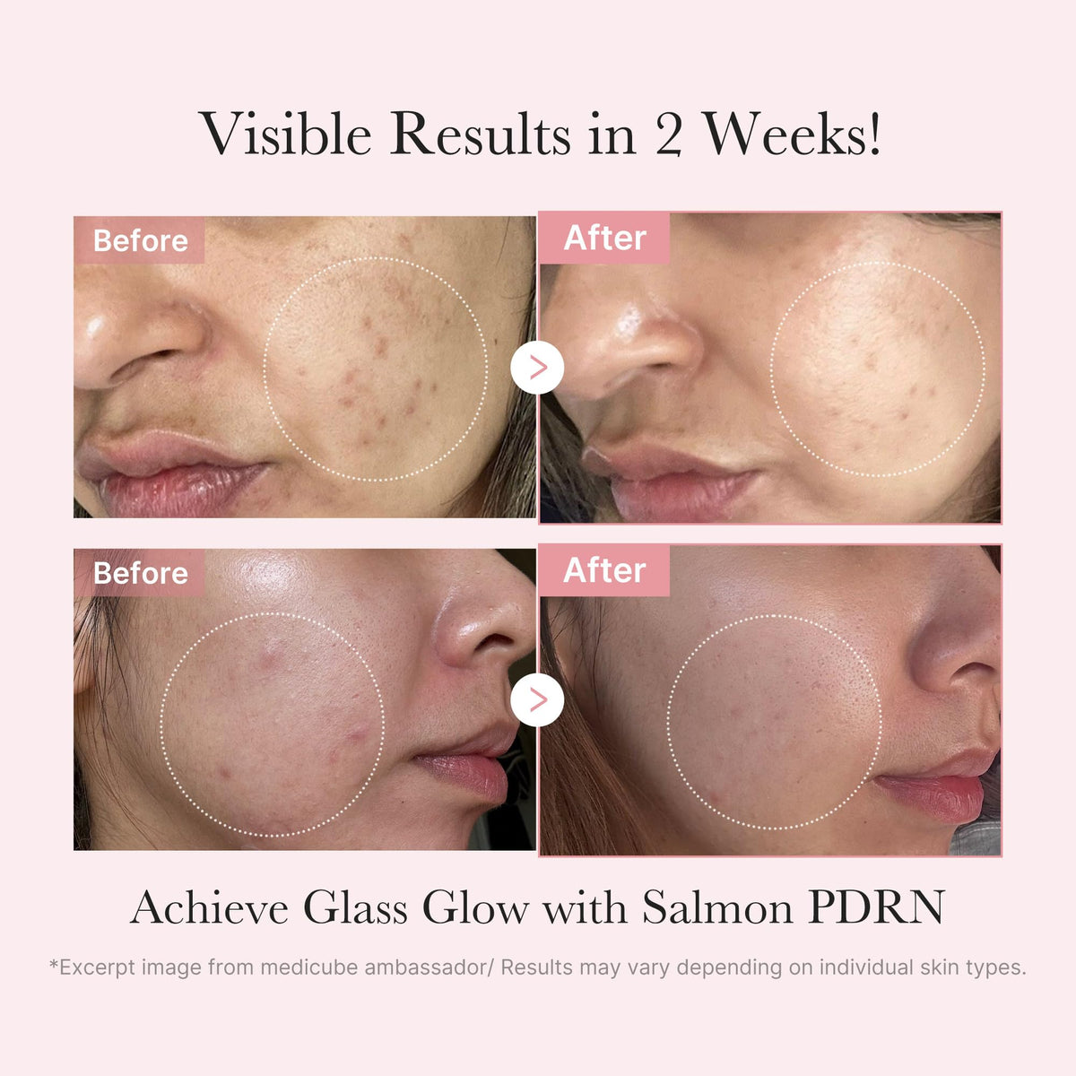 medicube serum ampoule dropper detail highlighting targeted treatment benefits