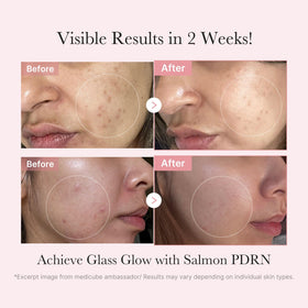 medicube serum ampoule dropper detail highlighting targeted treatment benefits