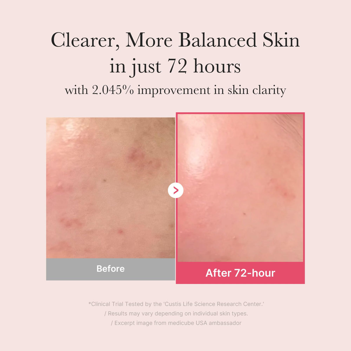 medicube serum texture close-up on skin, demonstrates fast absorption and smooth finish