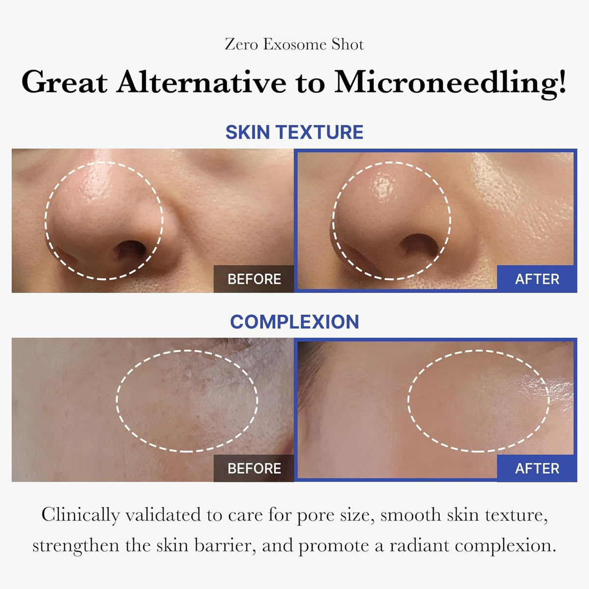 medicube close-up spicule texture revealing micro-needle delivery benefit