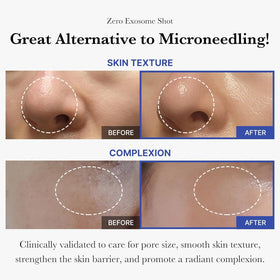 medicube close-up spicule texture revealing micro-needle delivery benefit
