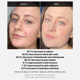 medicube application on cheek demonstrating one-minute wash-off routine