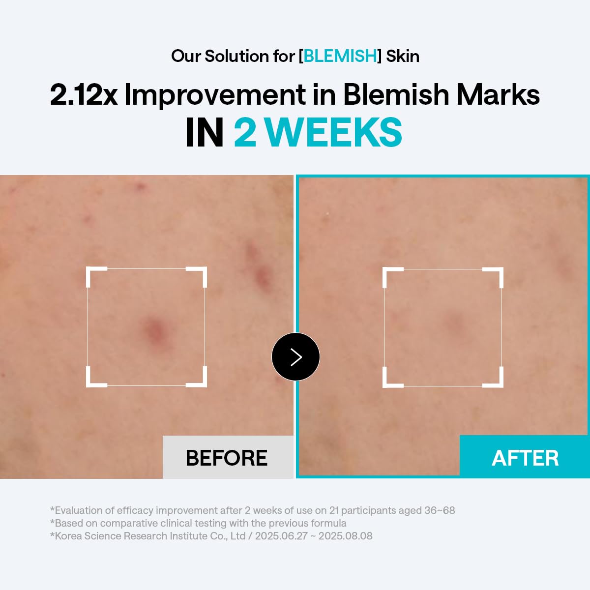 MEDIHEAL pad being swiped on face after cleansing for calming benefit