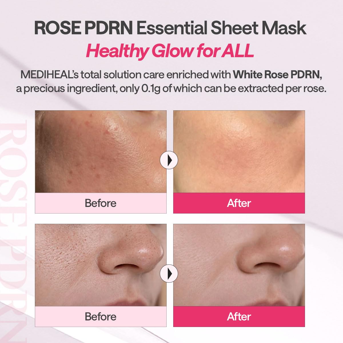 MEDIHEAL ingredient label detail highlighting white rose PDRN purity and clarity benefit
