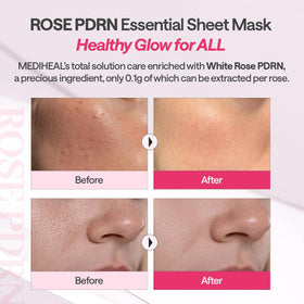 MEDIHEAL ingredient label detail highlighting white rose PDRN purity and clarity benefit