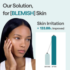 MEDIHEAL mask applied on model demonstrating soothing fit