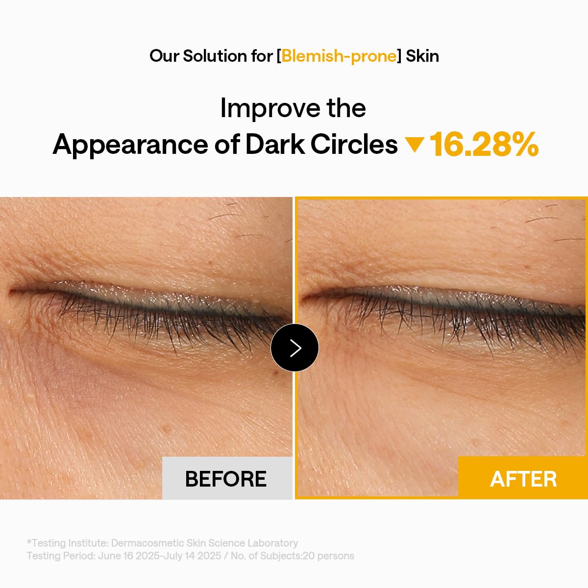 MEDIHEAL patch placed on smile lines and forehead to treat multiple zones