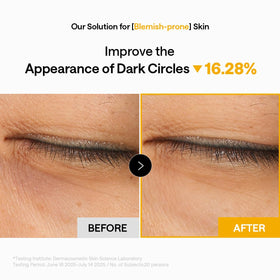 MEDIHEAL patch placed on smile lines and forehead to treat multiple zones