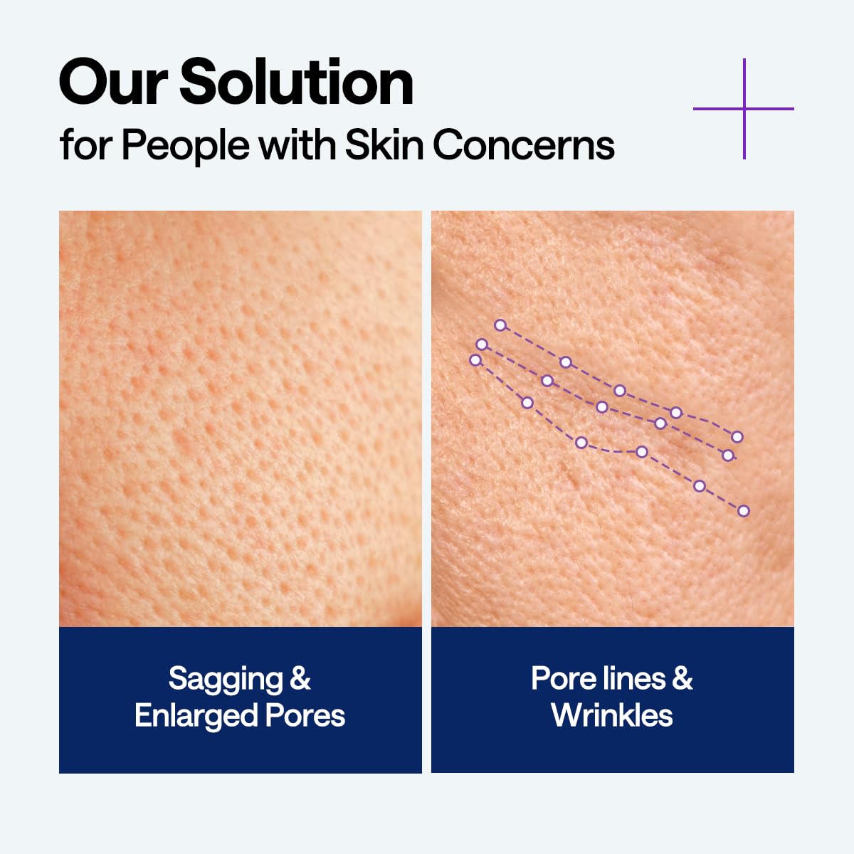 MEDIHEAL ingredient label close-up highlighting PDRN and squalane benefits