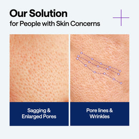 MEDIHEAL ingredient label close-up highlighting PDRN and squalane benefits