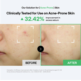 MEDIHEAL pad being swiped on cheek demonstrating quick oil-control benefit
