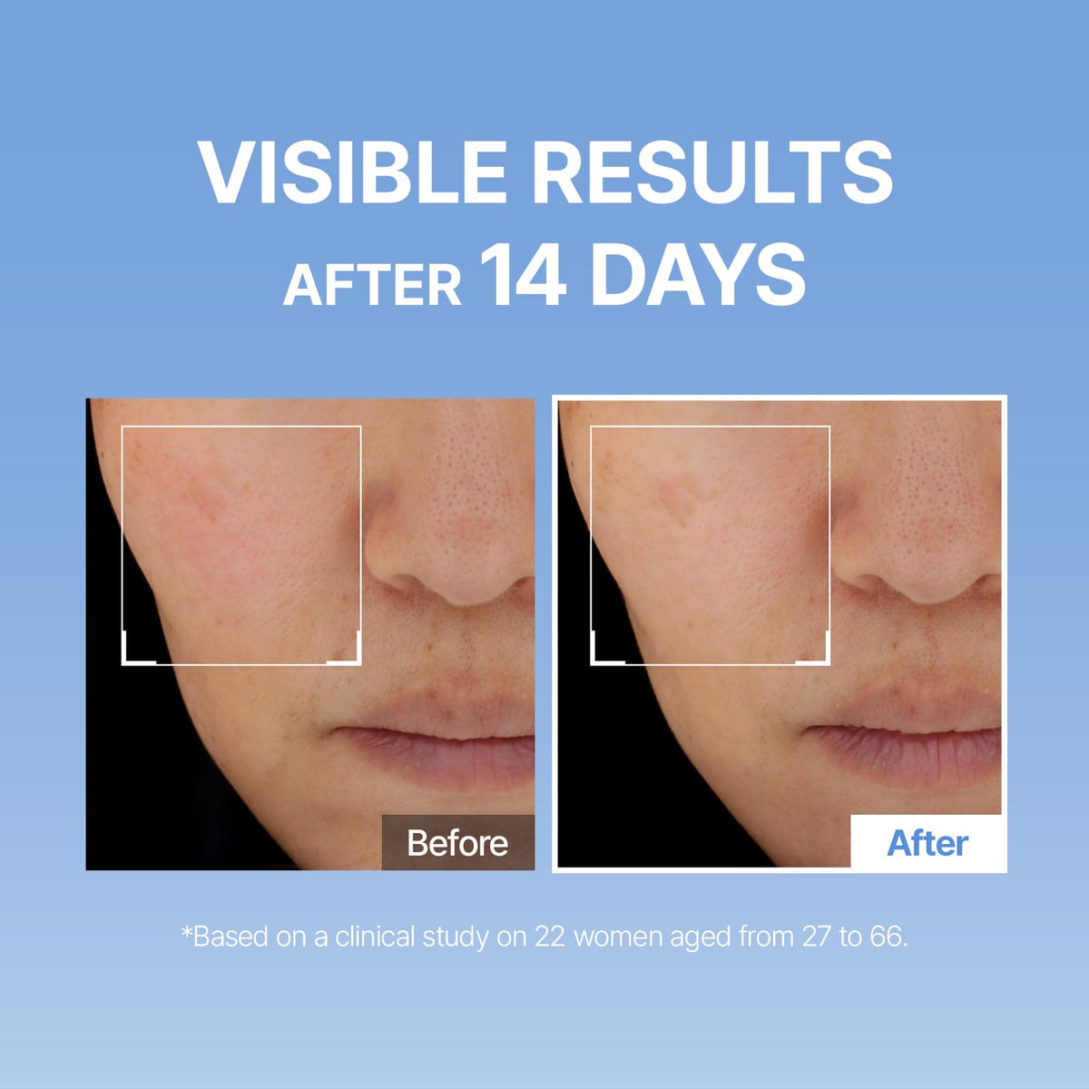 MEDITHERAPY pump dispensing clear serum to demonstrate easy, mess-free application advantage