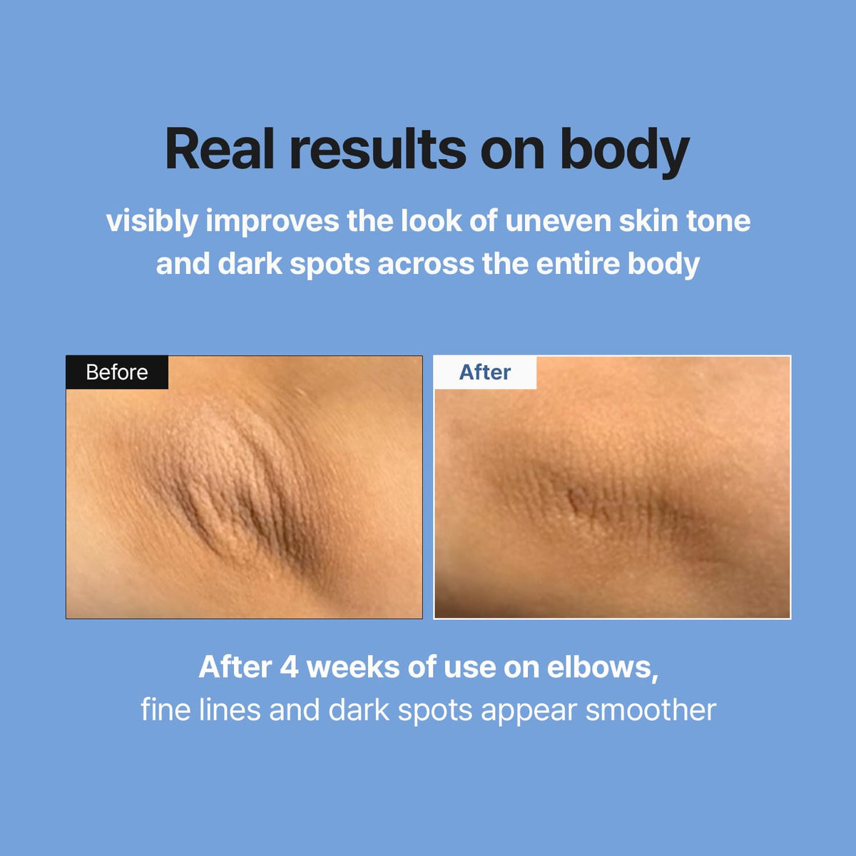 MEDITHERAPY niacinamide and Centella ingredient visual illustrating barrier support