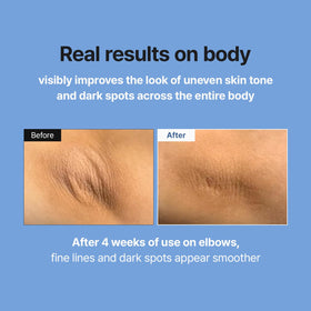 MEDITHERAPY niacinamide and Centella ingredient visual illustrating barrier support