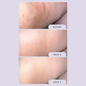 Megababe applying Night Rescue to inner thigh demonstrating targeted brightening and soothing action