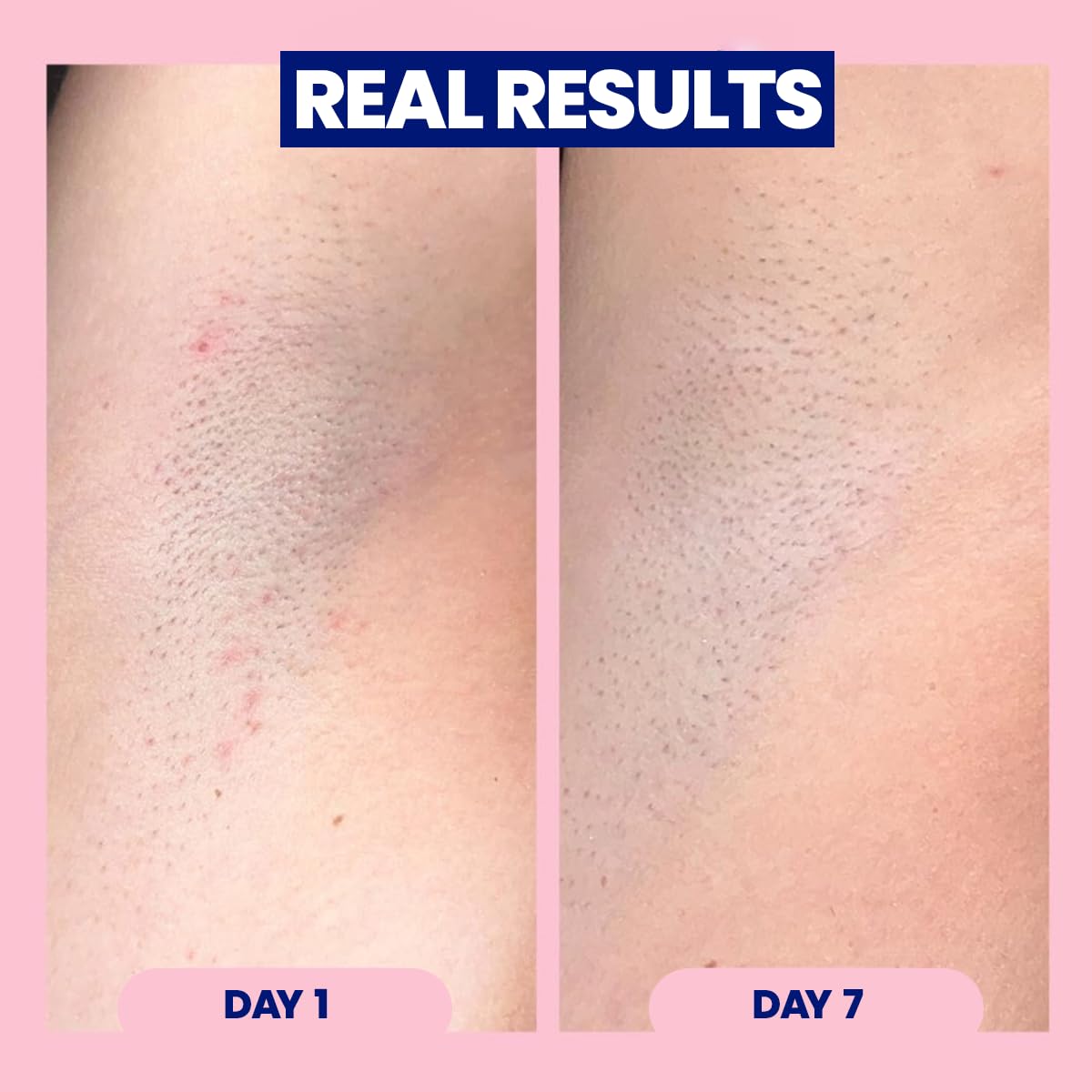 Megababe on underarm demonstrating gentle post-shave calming benefit