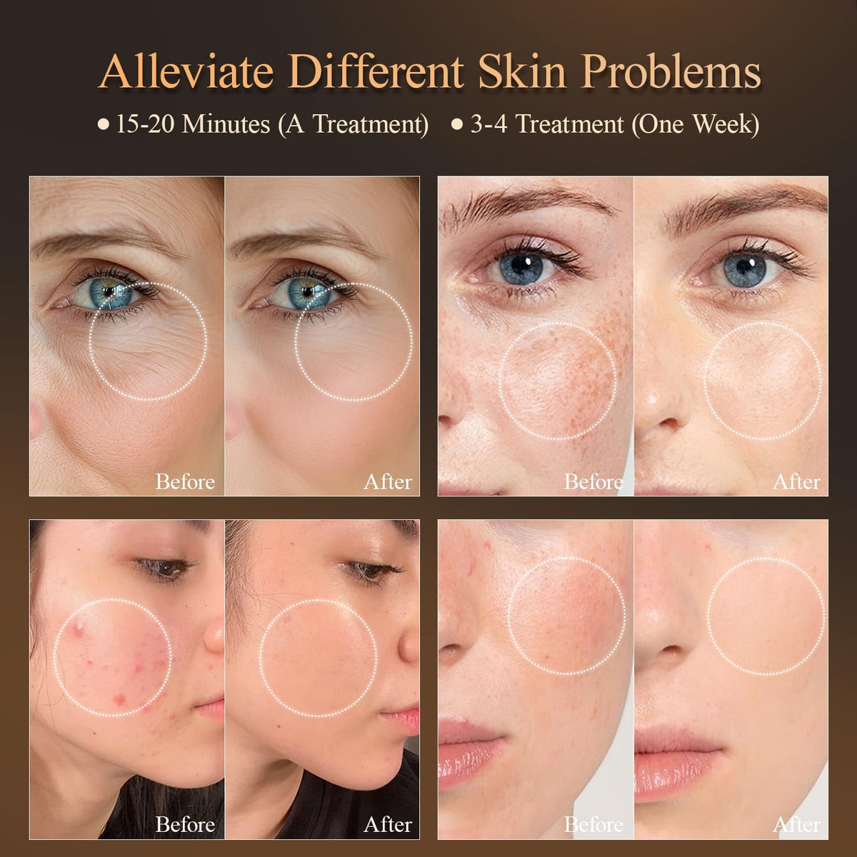 MEGELIN mask worn in use on model showing hands-free treatment convenience