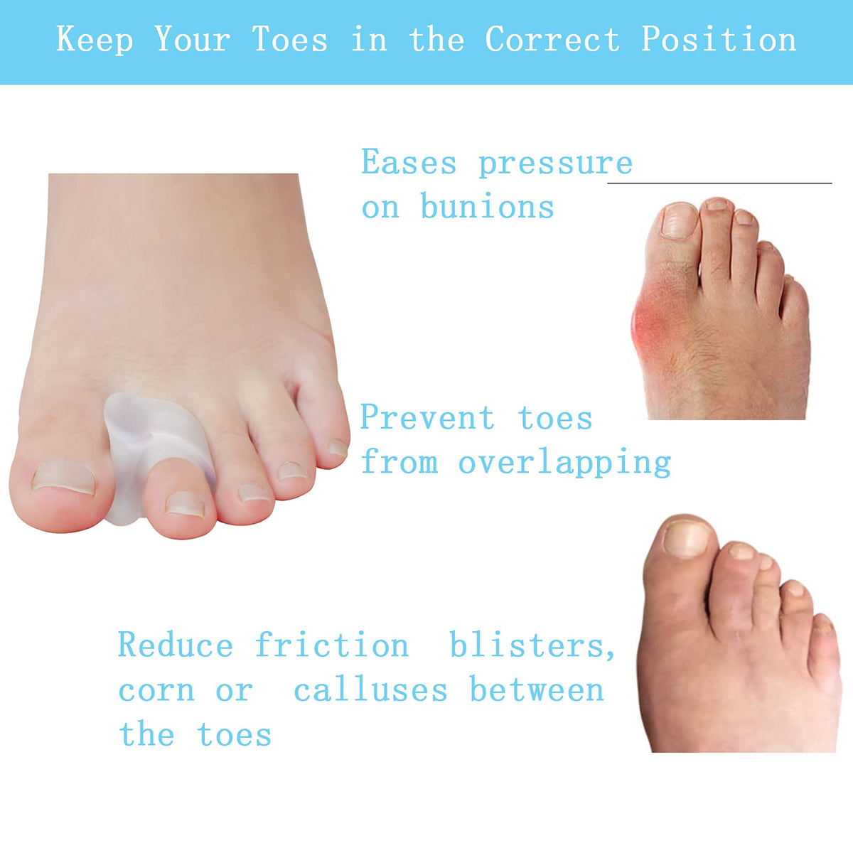 MENOCADY single-loop fitted on second toe showing secure fit benefit