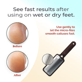 Microplane used dry on heel illustrating quick touch-up for softer skin