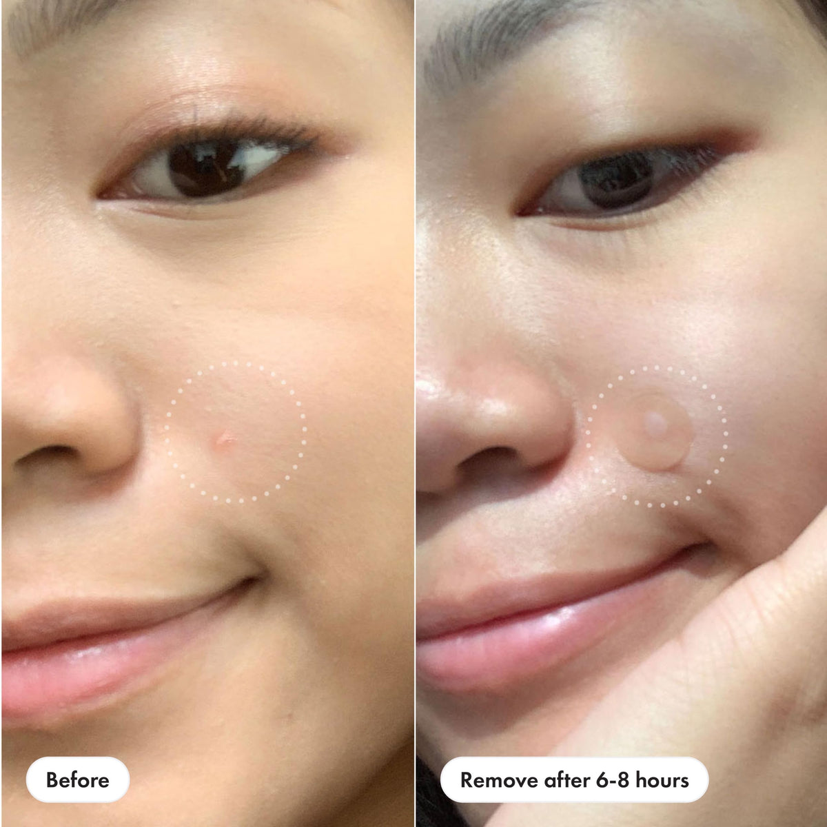 Used Mighty Patch with visible absorbed fluid illustrating progress