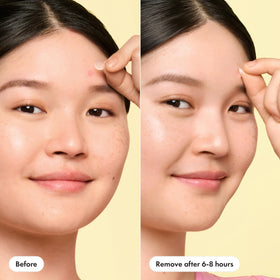 Mighty Patch blended on cheek demonstrating discreet daytime wear benefit
