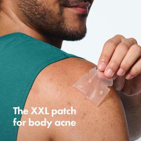 Close-up of a single Mighty Patch body patch showing medical-grade hydrocolloid