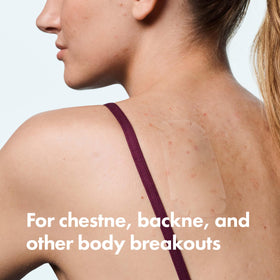 Detail of Mighty Patch notches and flexible film showing contour-fit benefit