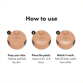Mighty Patch staying adhered during mouth movement for reliability