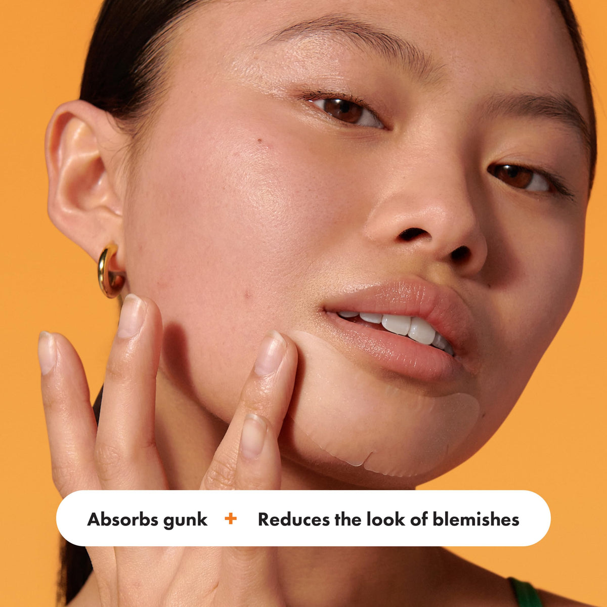 Mighty Patch applied to chin overnight demonstrating coverage