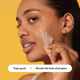 Mighty Patch applied on cheek illustrating coverage and overnight protection