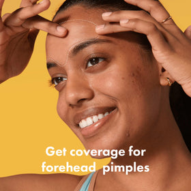 Mighty Patch forehead close-up texture showing smooth hydrocolloid surface that absorbs fluid