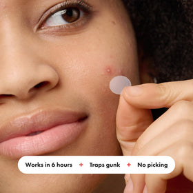 Mighty Patch applied on face overnight protecting and absorbing spot