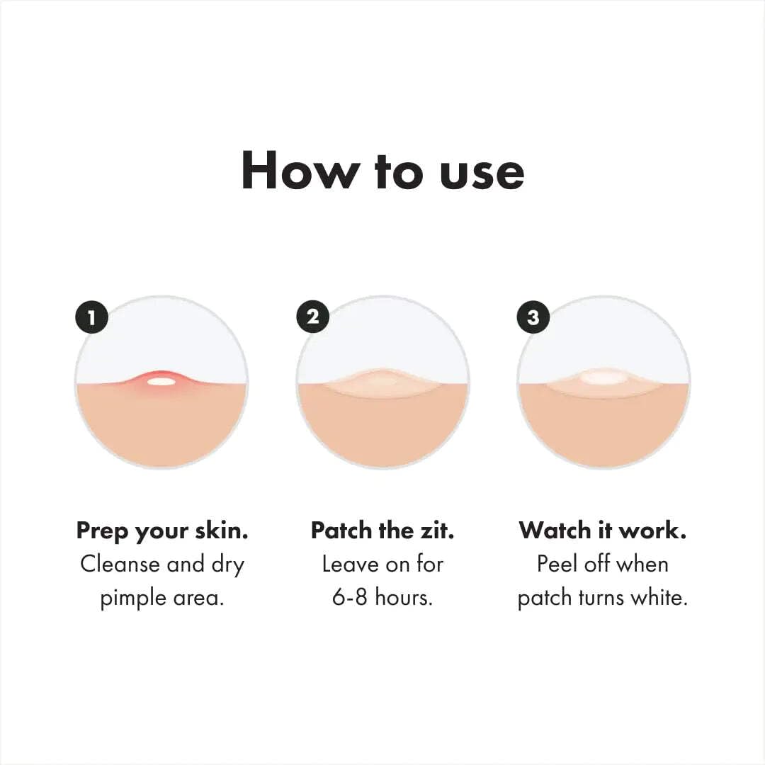 Mighty Patch Original on cheek overnight absorbing fluid for clearer-looking skin