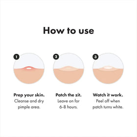 Mighty Patch Original on cheek overnight absorbing fluid for clearer-looking skin