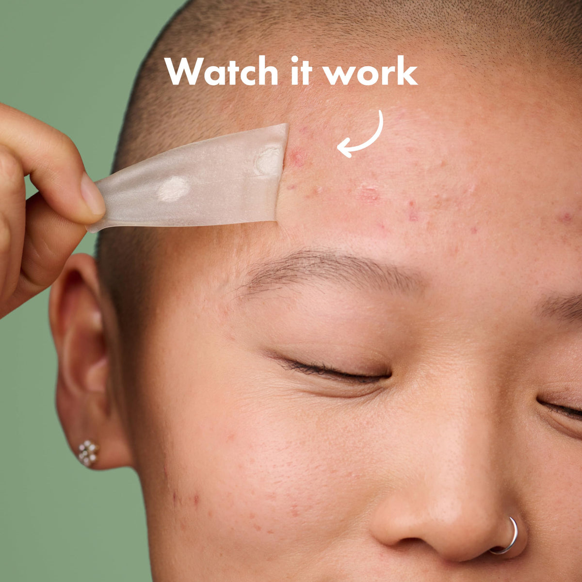 Mighty Patch applied to jawline illustrating secure fit and protection during movement