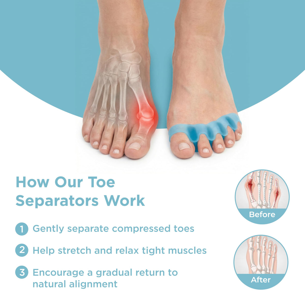 Mind Bodhi used during pedicure for toe separation benefit