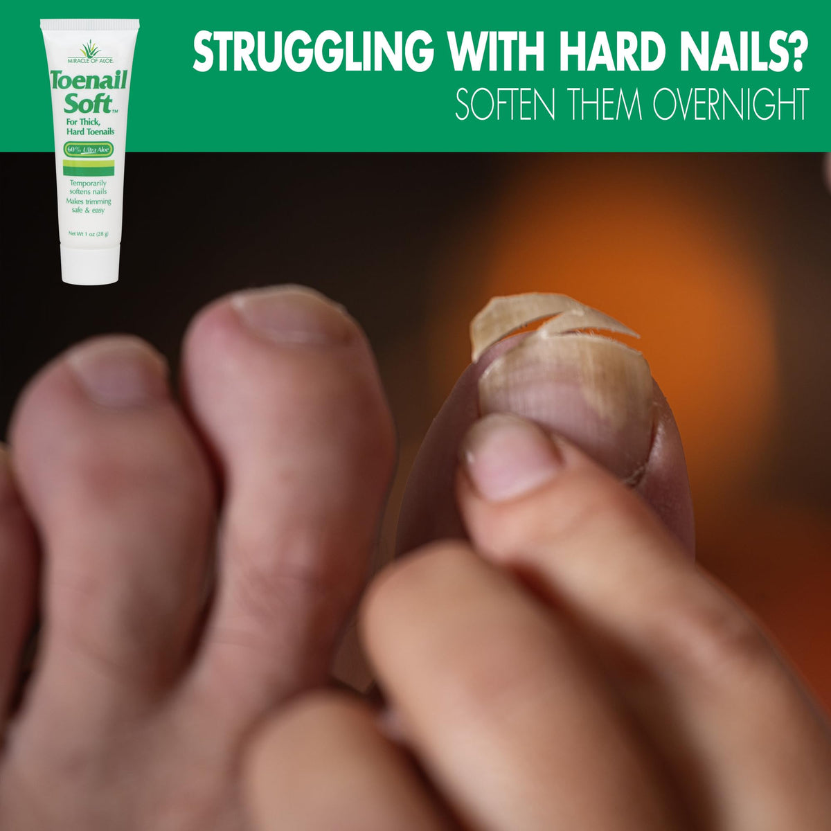 Miracle of Aloe being applied to toenail at night for overnight softening
